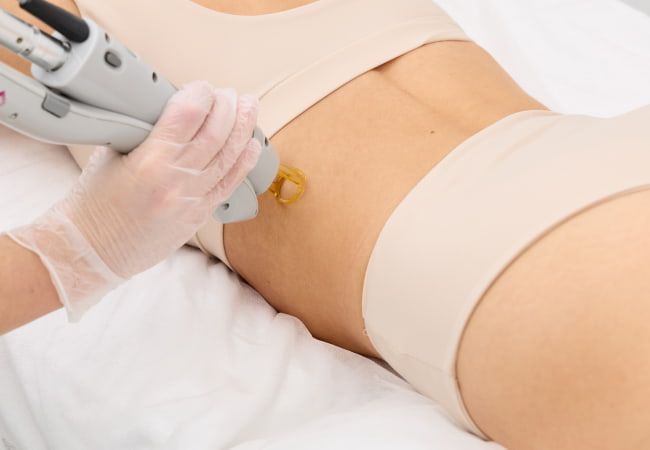 эпиляция спины для мужчин цена